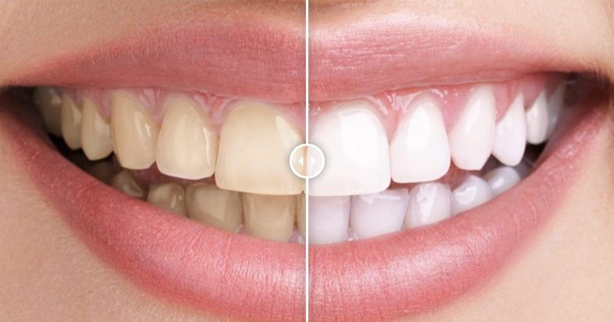 Before & After Images Comparison WordPress Plugin 1.0.1